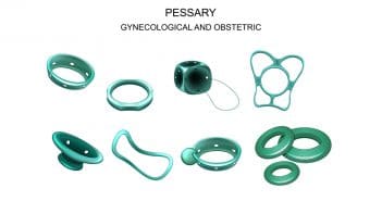 Pessaire versus cerclage versus expectative pour les cols ouverts avec la poche des eaux visibles au deuxième trimestre