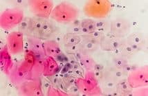 Dernières recommandations concernant le dépistage HPV chez les patientes VIH