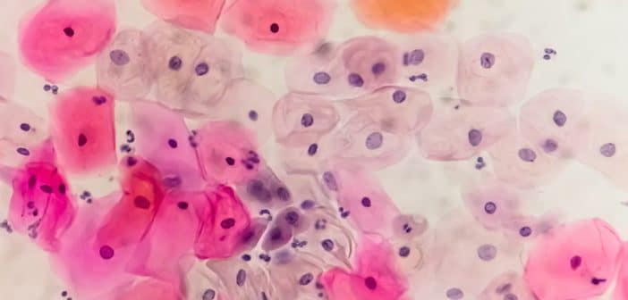 Fiche pratique : Dernières recommandations concernant le dépistage HPV chez les patientes VIH Dernières recommandations concernant le dépistage HPV chez les patientes VIH