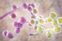 Vulvovaginite candidosique récidivante, diabète et inhibiteurs du cotransporteur sodium-glucose de type 2